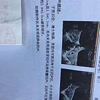 拜托，各位帮我看看，现在很担心，有没有一样的宝妈