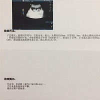 那个能帮帮看看，单上的是女宝还是男宝呀？