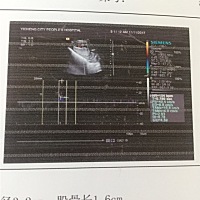 带把的？16周😁