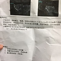 我是九月4号最后一次月经，九月底测的时候还没有怀孕，十月初也没有，十月十五号才发现怀孕，医生是按最...