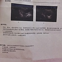 今天检查医生说疤痕妊辰。希望宝宝健健康康的.希望成功
