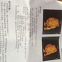 能看出来男孩女孩吗？预产期18年2月7号