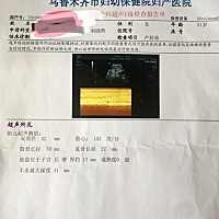 各位有经验宝妈给看一下男宝宝还是女宝宝，本人也只是好奇