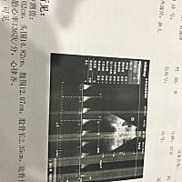 能看出男宝女宝么