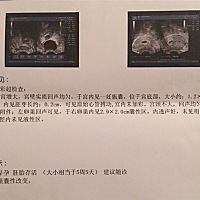 怀孕6周 ，一直没有孕吐症状。近几天一直拉肚子，偶尔肚子还一直咕咕叫又不是饿的感觉。有褐色分泌物能...