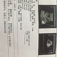 谁会看啊！男宝还是女宝