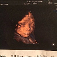 猜男女啦！全程无任何反应口味变了以前从不吃甜食跟肉，现在是想起巧克力面包肉就流口水😂😂肚子不...