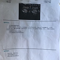 专业人士帮忙看下男宝还是女宝，谢谢！