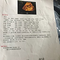 亲们 能帮我看下是男宝女宝抱拳了❤️