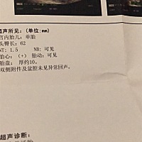 这能看得出男包还是女宝呢。孕妈们求指点