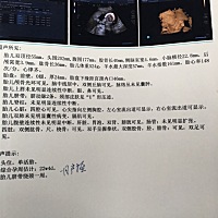 好奇是男宝贝还是女宝贝