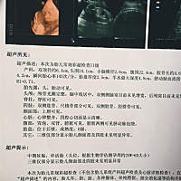 34周了 想让宝妈们帮忙看看男女