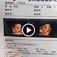 有懂的吗，四维一次性通过，看看样子像男孩女孩