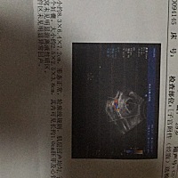 能看得出男孩女孩嘛 是二宝