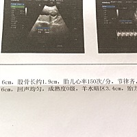 有哪位姐姐会看的 是女宝宝还是男宝宝呀