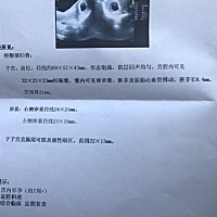 第一胎、纯属好奇 是男是女？？ 帮看一下