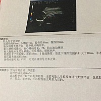 能看出来宝宝情况吗 好想知道男孩女孩 该准备小衣服啦😊
