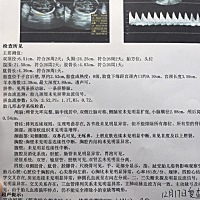 有经验的宝妈们看看，是儿子还是闺女呀？今天刚做的四维。谢谢啦～