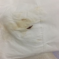 今天孕九周，前期没有任何早孕反应和身体不适。今天中午十二点回家上厕所突然这样了，有没有危险😭用...