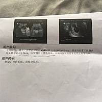 这样能看出是男是女吗？谁是专家请留言，8周 2天