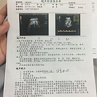 宝妈们帮忙看看是男宝还是女宝？现在还不知道买生活颜色的衣服给宝宝😊