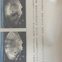 大家看见过这样的字眼吗？张力欠佳！痛苦崩溃中