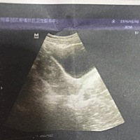 今天医生一开始看说好像是双子宫，后来又不确定，又看了看，最后也没有说是不是双子宫就说胎盘低，大家...