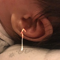 二十几天宝宝耳朵肉突出怎么回事？算正常吗？