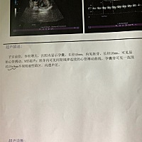 请问大家这有没有事啊，担心坏了