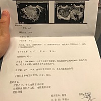有没有备孕的 这样能怀孕么 担心