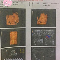 宝妈们 把我看看我娃是男孩还是女孩 谢谢