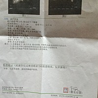 昨天去产检，这是昨天的B超单，看得出男女吗？讨论一下呗！