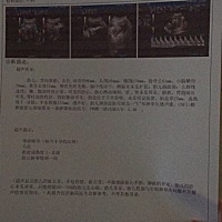 今天照B超、验血验尿，医生说有点贫血，蛋白质不高、尿了有血丝，唉好担心😫