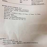 男宝还是女宝🤗