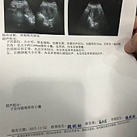 这是什么意思，麻烦大家帮忙看下