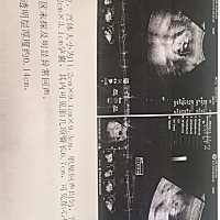 帮忙看下男孩还是女孩