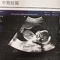 好可爱，有人能看出男女吗