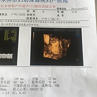 刚才忘记发照片了，宝妈们帮忙看看是男宝宝还是女宝宝