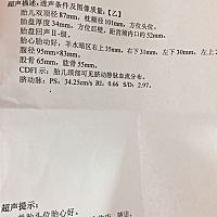 怎么算男孩女孩儿呀？