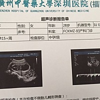 麻烦大家帮忙看一下是男孩还是女孩