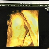 宝贝期待与你相见！！！