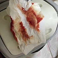 怀孕36天了早上起来流了好多血心塞