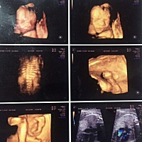 哈哈、各位宝妈们  能否看出男宝女宝哈、出于好奇心^_^