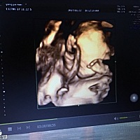 这是男宝宝么？