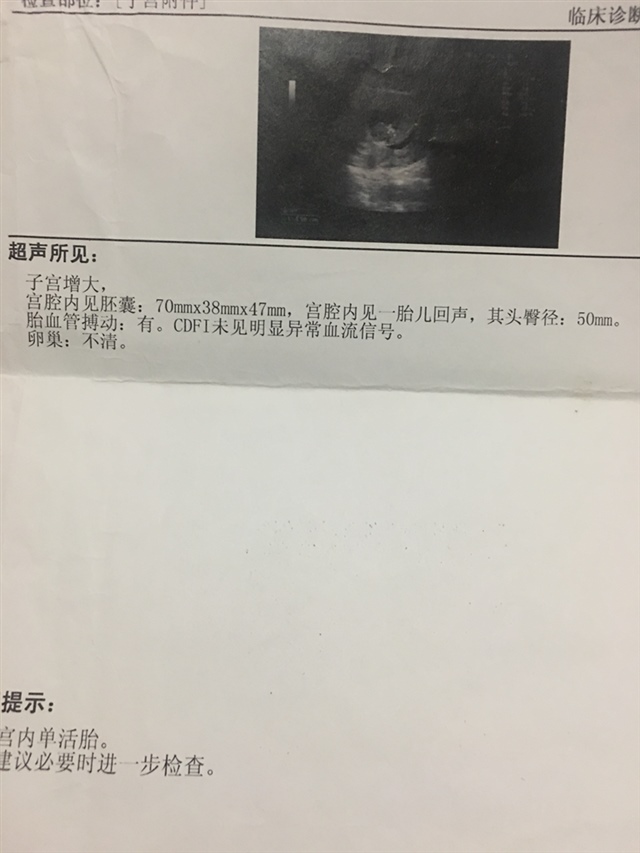 姐妹们满足我一下好奇心，谁看男宝还是女宝