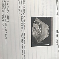 怎么看男孩女孩，现在能看出来了吗