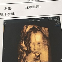 小宝宝，妈妈👩爸爸👨爱你😘，希望你足月平安出生🐣，健康长大有作为！这是你的第一张照片！�...