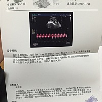 大神们帮我看看是男孩？还是女孩？因为第一胎、无论什么都开心迎接宝贝、末次经期7月11日、19周查的彩超...