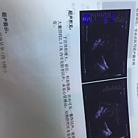 能不能给看看男孩女孩 🙏🏻