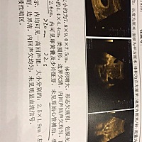 医生都建议流掉.......我好纠结，明天就要住院了，哎，有宝妈和我有一样情况好转的吗？希望今晚有好答案...